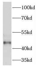 TGDS antibody|TGDS抗体
