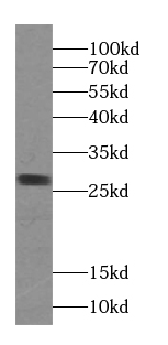 VAPB antibody|VAPB抗体 FNab09371