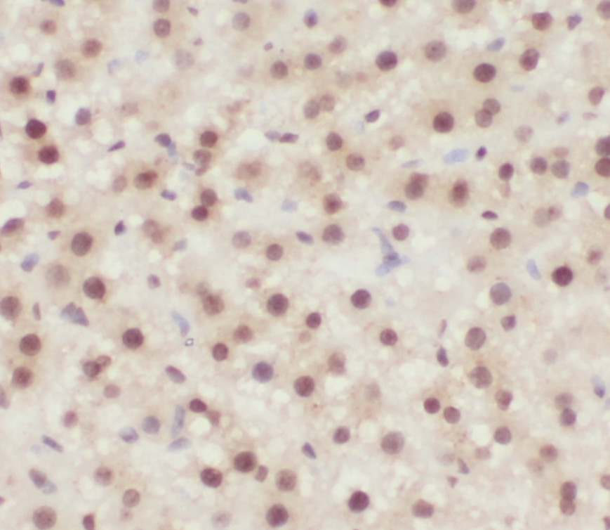 ONECUT1 antibody|ONECUT1抗体