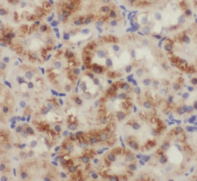 PBDC1 antibody|PBDC1抗体