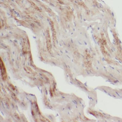 SLC25A20 antibody|SLC25A20抗体