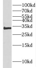 HOXC8 antibody|HOXC8抗体