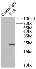 PI4KB antibody|PI4KB抗体
