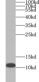 S100A3 antibody|S100A3抗体