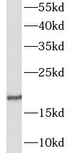 GALP antibody|GALP抗体