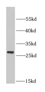 MIP antibody|MIP抗体