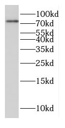 FAM114A1 antibody|FAM114A1抗体