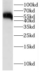 LCK antibody|LCK抗体 FNab04726