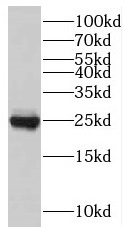 TNNI1 antibody|TNNI1抗体 FNab088
