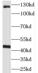 RIMBP2 antibody|RIMBP2抗体