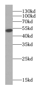 KRT7-specific antibody|KRT7抗体 
