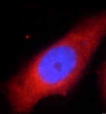 PTGS2 antibody|PTGS2抗体 FNab018