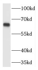 TPTE antibody|TPTE抗体