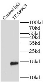 TFAP2C antibody|TFAP2C抗体