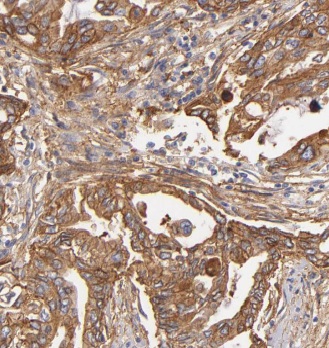 MRPL48 antibody|MRPL48抗体