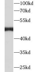 TPH1 antibody|TPH1抗体