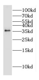 DOK5 antibody|DOK5抗体