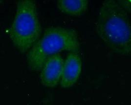 RPL18A antibody|RPL18A抗体 FNab0