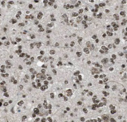 PLCB1 antibody|PLCB1抗体