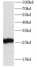 CCDC85B antibody|CCDC85B抗体