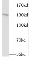 STK10 antibody|STK10抗体