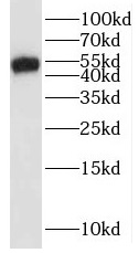 ONECUT1 antibody|ONECUT1抗体