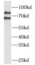 MLPH antibody|MLPH抗体 FNab05120
