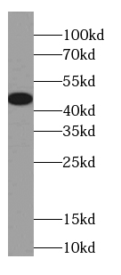 GJA3 antibody|GJA3抗体 FNab01863
