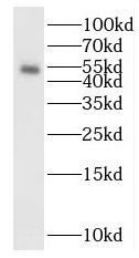 SMAD5 antibody|SMAD5抗体