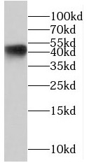 PPP1R7 antibody|PPP1R7抗体