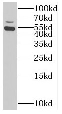 SUOX antibody|SUOX抗体