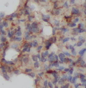 ARHGEF1 antibody|ARHGEF1抗体 FNa