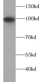 TXNDC16 antibody|TXNDC16抗体