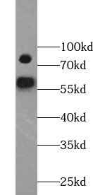 YY1AP1 antibody|YY1AP1抗体