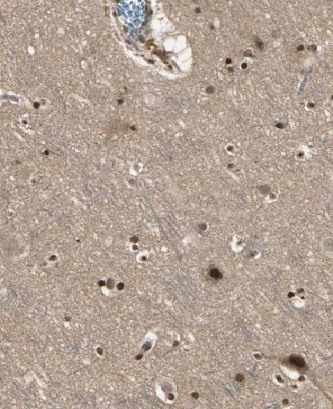 MT3 antibody|MT3抗体