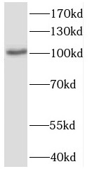 CWF19L2 antibody|CWF19L2抗体