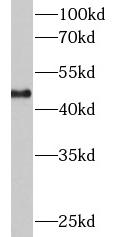 KRT18 antibody|KRT18抗体 FNab022