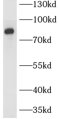 Slco4c1 antibody|Slco4c1抗体