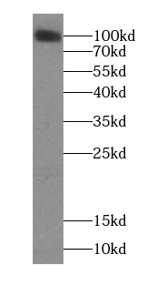 ITGA9 antibody|ITGA9抗体