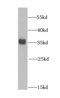 HNRNPA0 antibody|HNRNPA0抗体