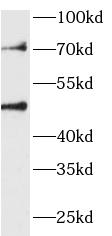 RCC1L antibody|RCC1L抗体 FNab094