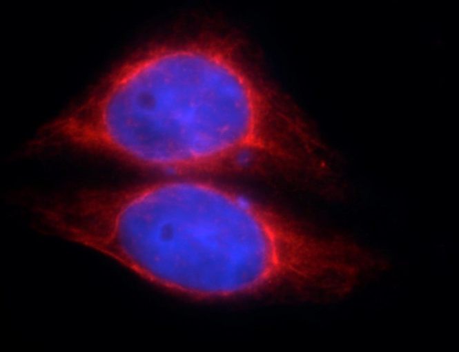 SOCS3 antibody|SOCS3抗体
