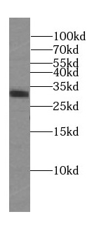 SUMF2 antibody|SUMF2抗体