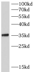 SRSF7 antibody|SRSF7抗体