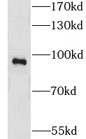 CNGA3 antibody|CNGA3抗体