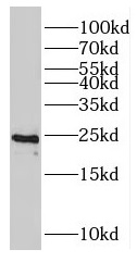 RALA antibody|RALA抗体