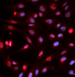APEX1 antibody|APEX1抗体 FNab004