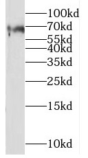 NECTIN3 antibody|NECTIN3抗体