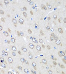 RPN2 antibody|RPN2抗体