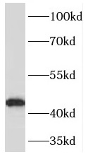 PDHA1 antibody|PDHA1抗体 FNab062